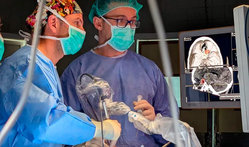 Cirugía cerebral sin craneotomía: el Virgen del Rocío revoluciona el tratamiento de tumores
