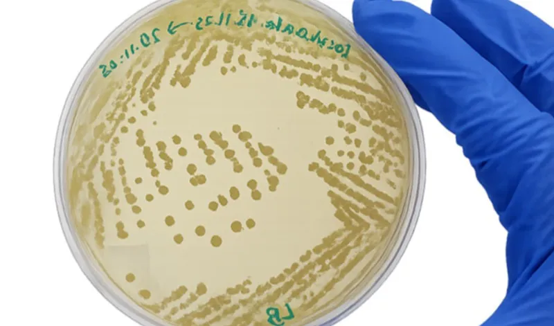 Bacterias de depuradora andaluzas eliminan ibuprofeno en suelos agrícolas en tres días