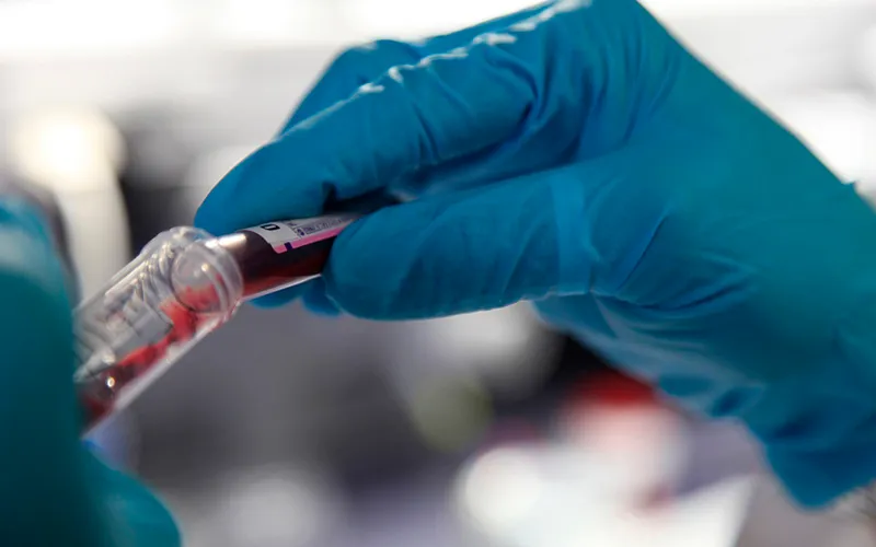 La Rioja moderniza sus laboratorios clínicos con un nuevo sistema de información