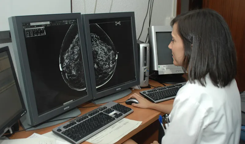 Junta de Andalucía licita unidades móviles para cribado de cáncer de mama en zonas rurales
